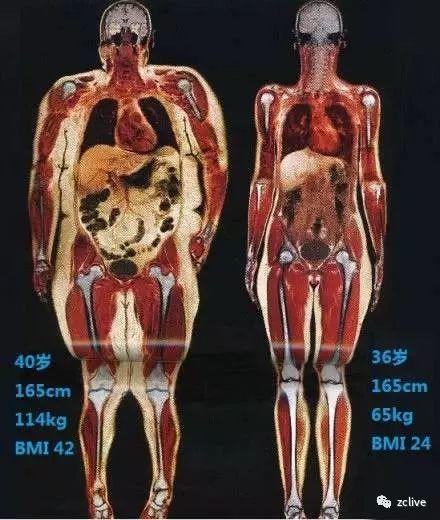体重相同为什么体型差别这么大？减肥就是减重么？