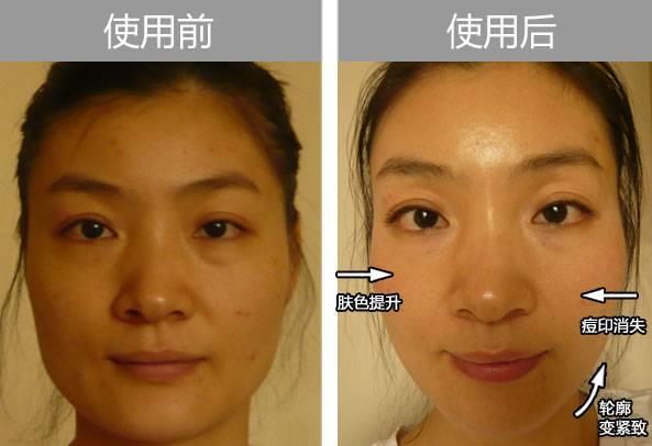 NU SKIN ageLOC™焕新系列—极致抗衰