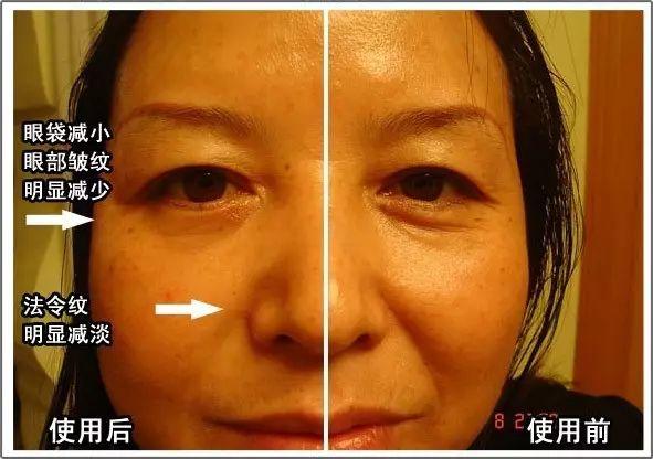 NU SKIN ageLOC spa机超多见证，以后再也不要问我是不是P的图啦！