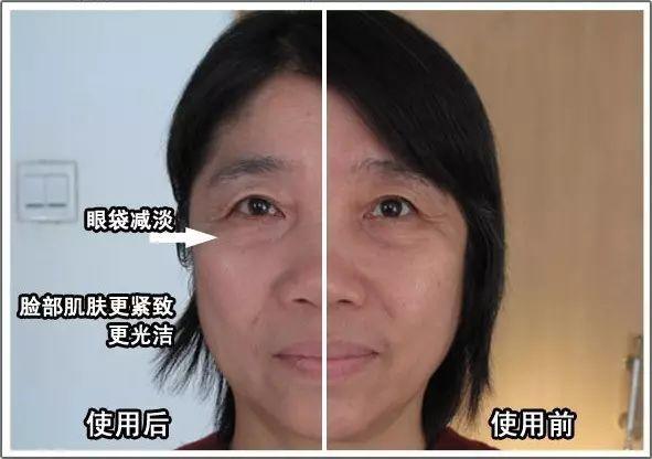 NU SKIN ageLOC spa机超多见证，以后再也不要问我是不是P的图啦！