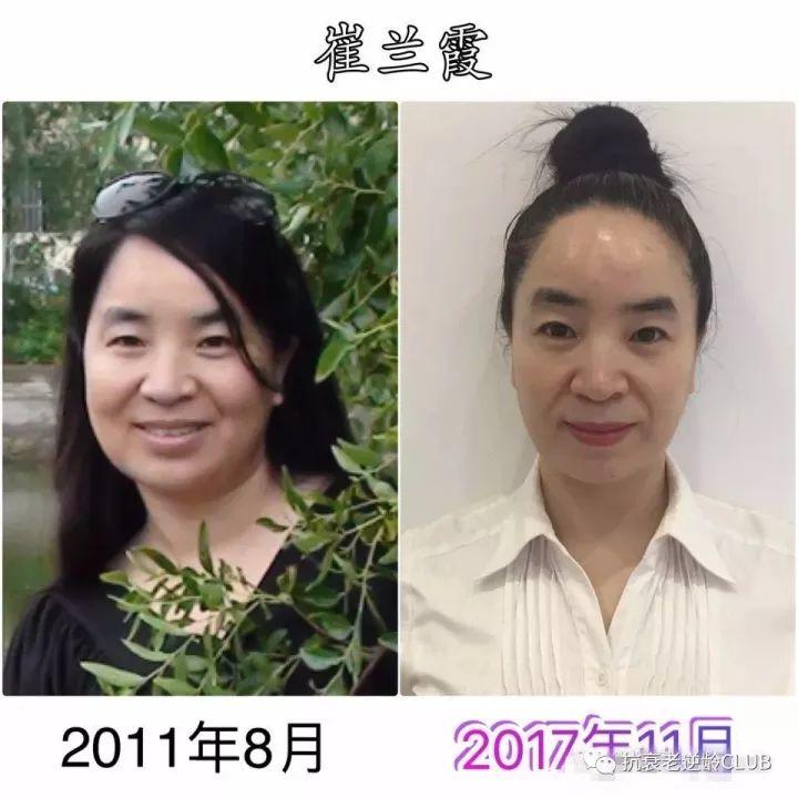 【抗衰老】NUSKIN让母子变姐弟--崔兰霞